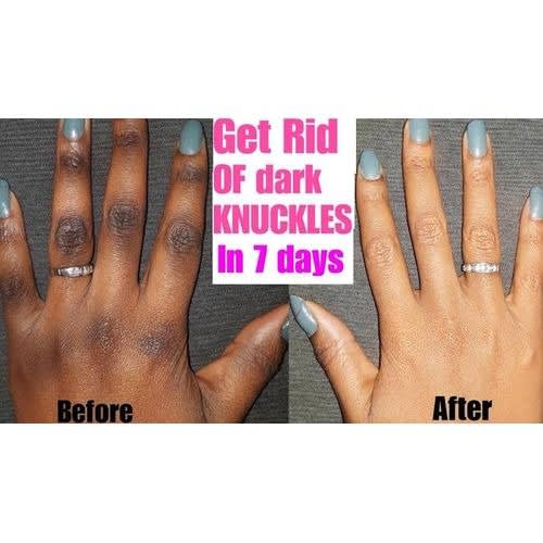Dark Knuckles/Dark Spots Repair Hand Cream - 150ml