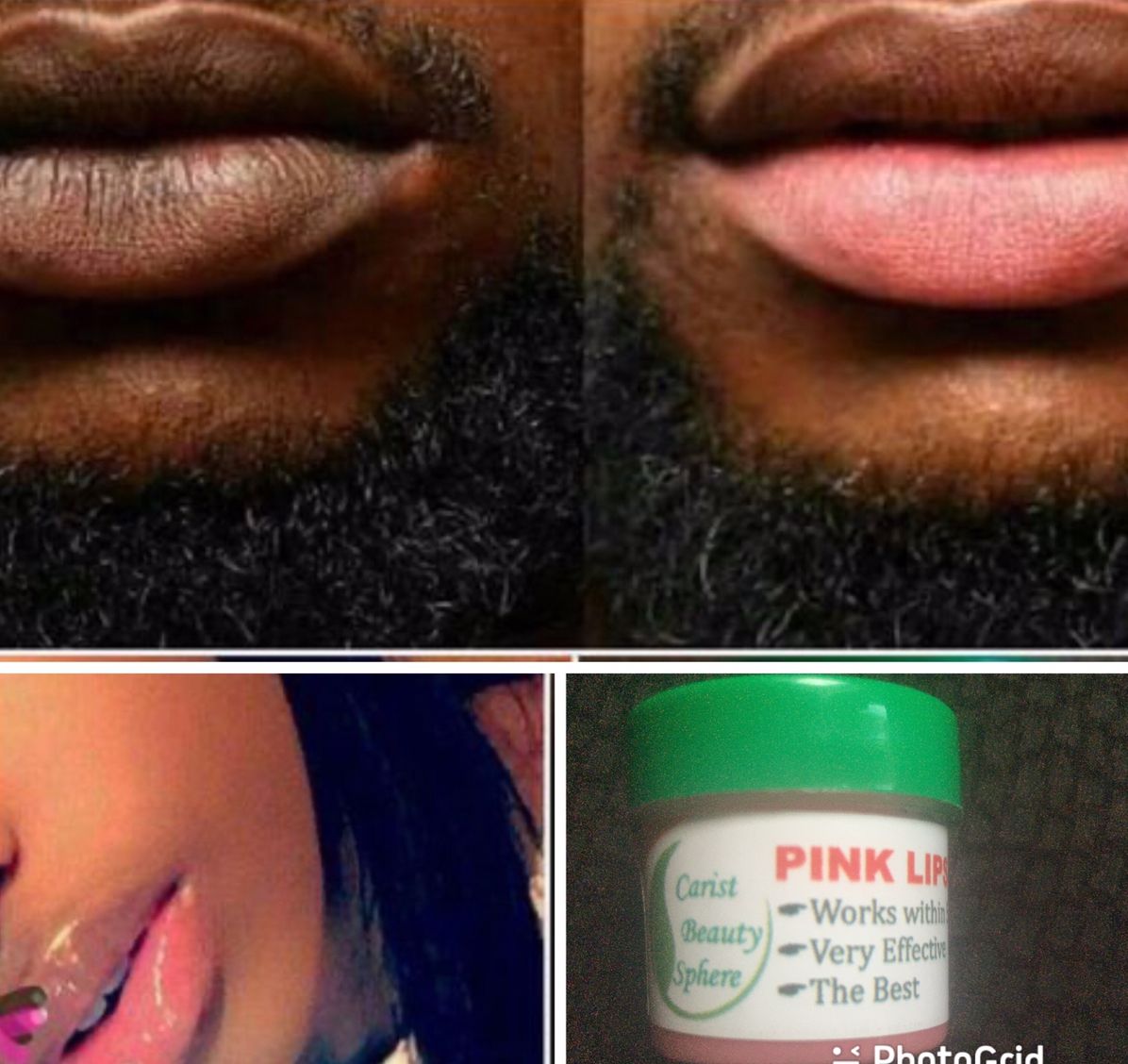 Unisex Permanent Pink Lips Balm/Cream(RESULT IN 3 DAYS)-this Brought Gives Natural Pink Lips Look