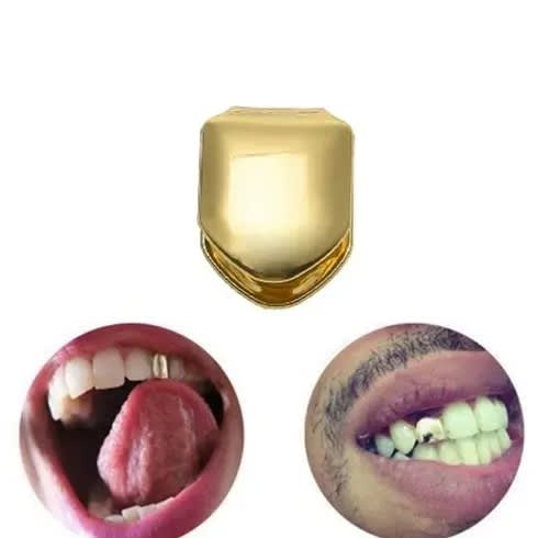 Gold Plated Teeth