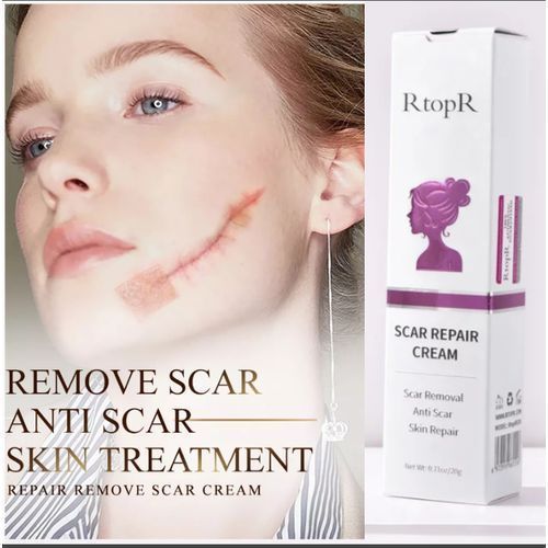 Keloids Scar Cream - Acne Scar Stretch Marks Remover Keloids Cream Skin Repair Face Cream Acne Spots Acne Treatment Blackhead Whitening Cream Skin Care