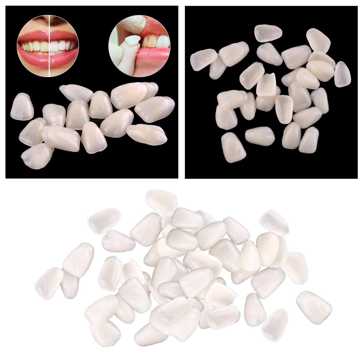 Teeth Temporary Veneers Front Synthetic Resin Whitening Mixed Beige