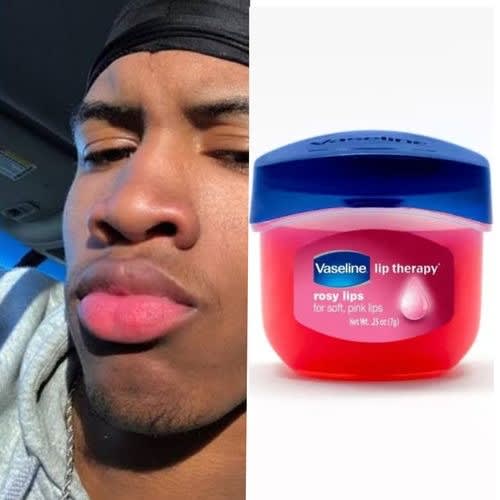Unisex Lips Therapy - 3 Days Active