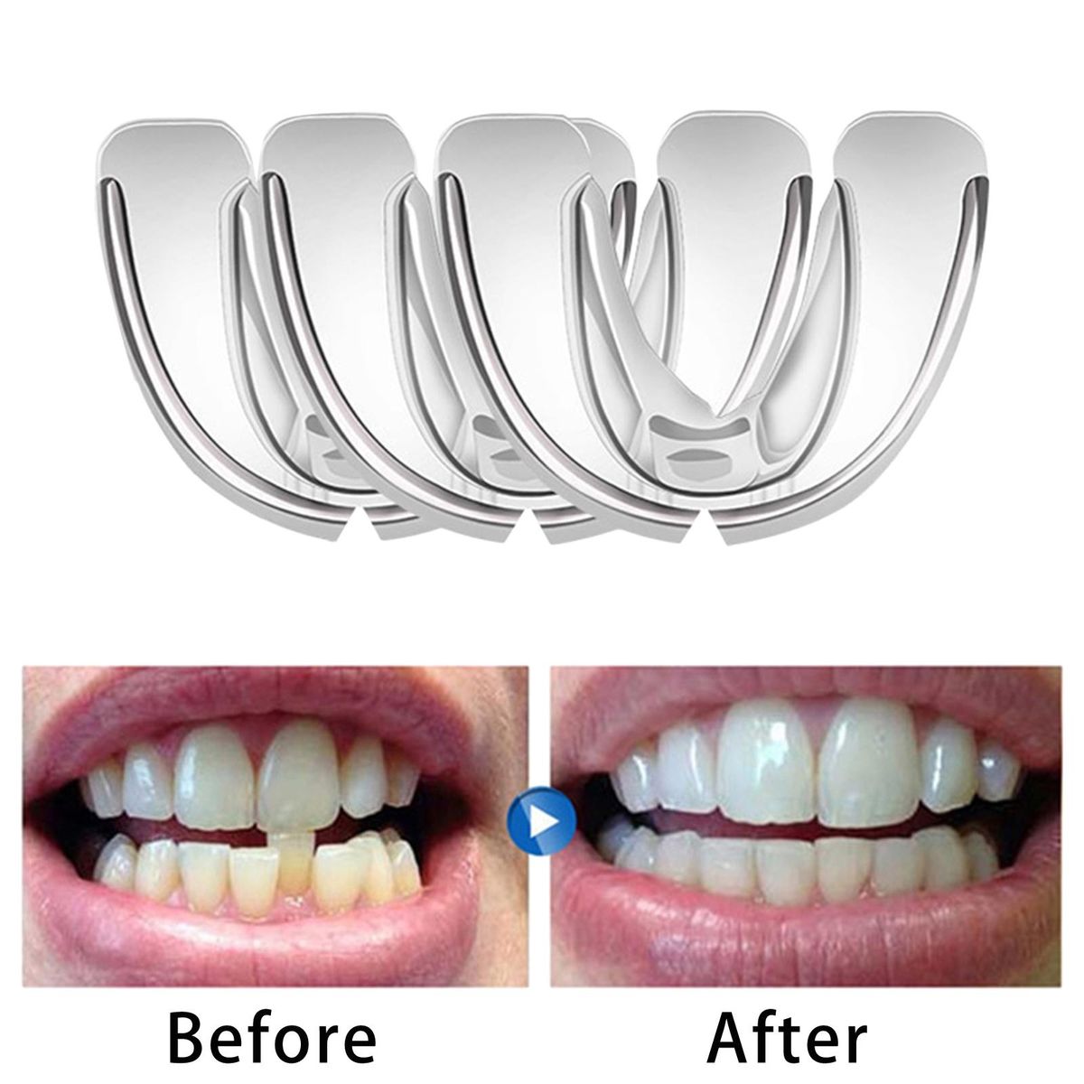 3-In-1 Hard And Soft Teeth Retainer Straighten Corrector Orthodontic