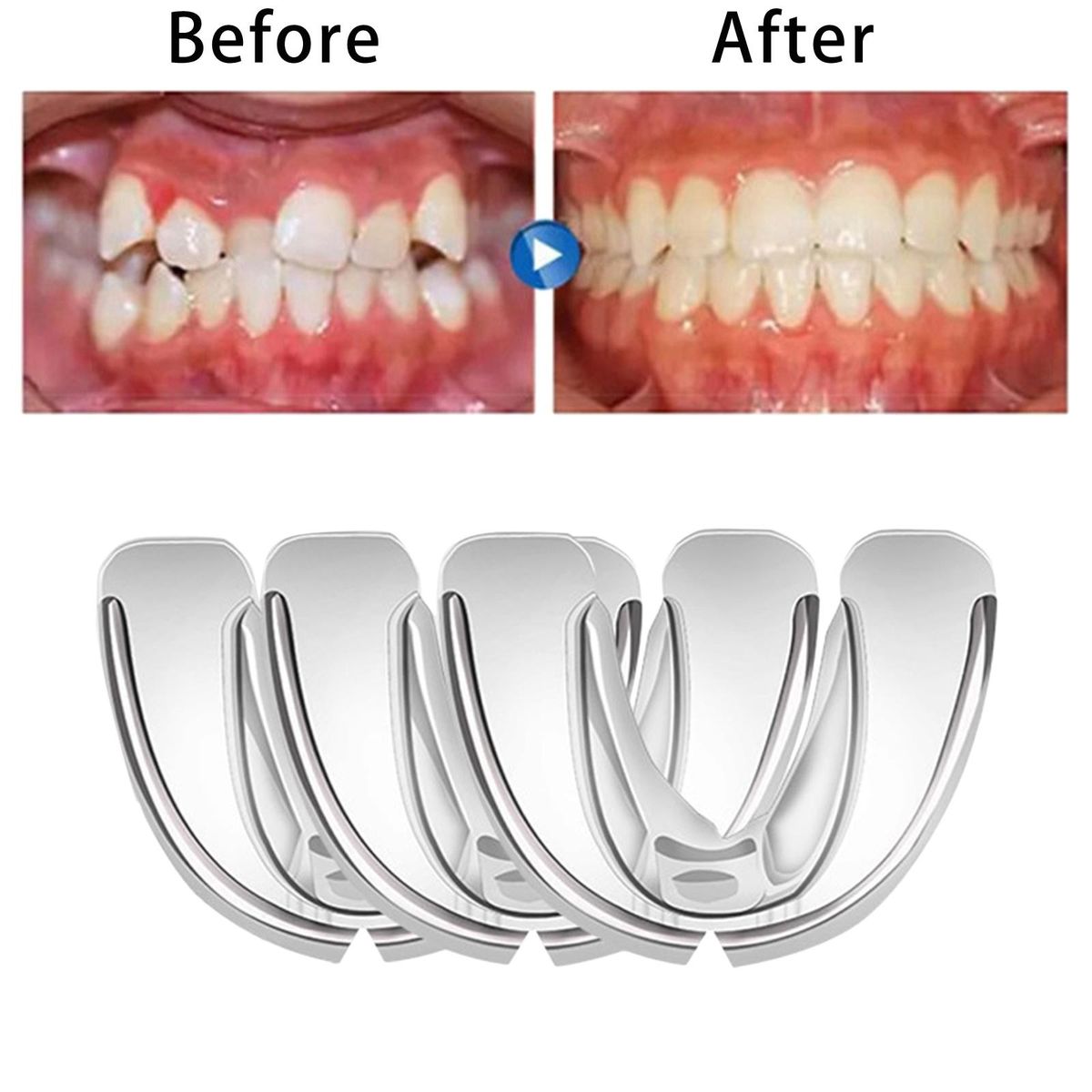 3-In-1 Hard And Soft Teeth Retainer Straighten Corrector Orthodontic