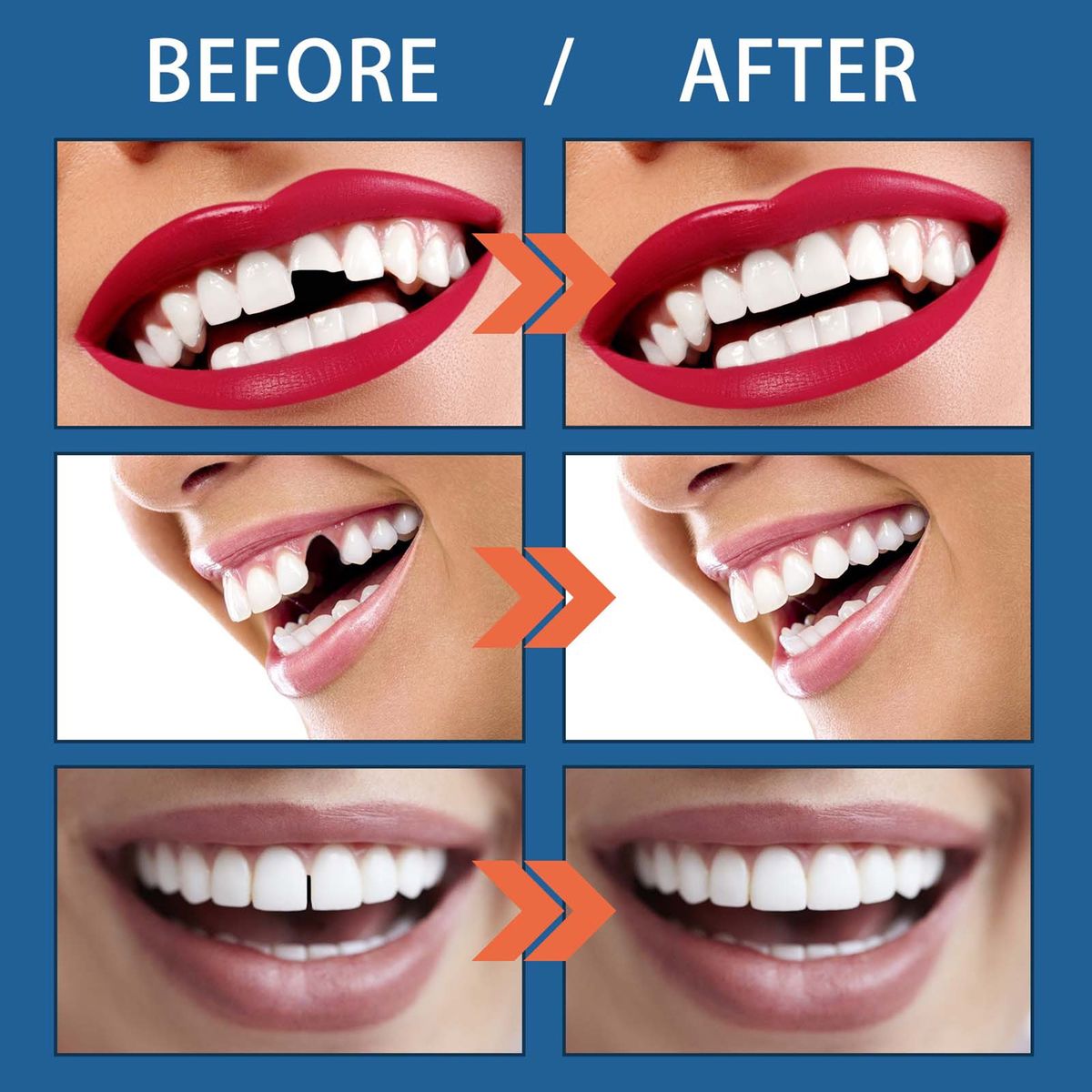 Moldable False Teeths 25g/Bottle Denture Cosplays