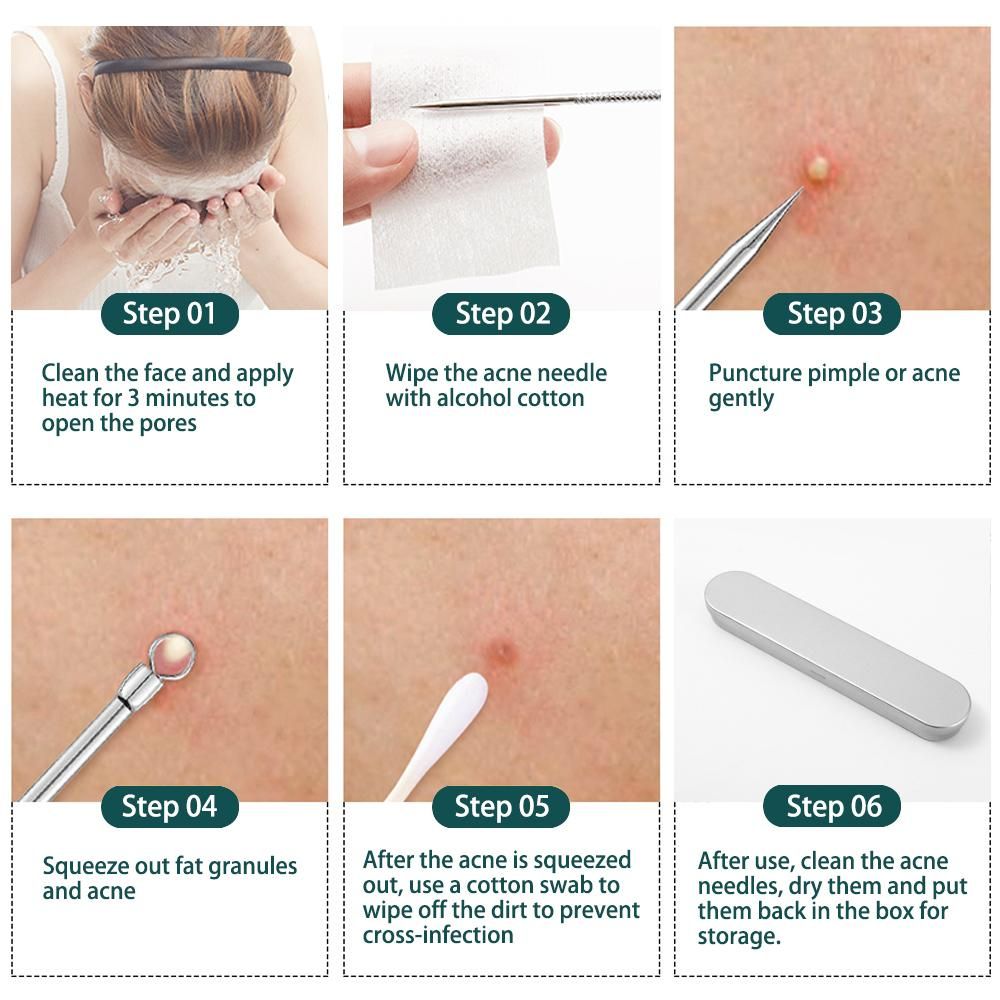 4PCS / 8PCS Blackhead Remover Kit, Comedone Pimple Extractor Tool Acne Removal Kit Blemish Remover Set for Blackhead, Whitehead Popping with Case