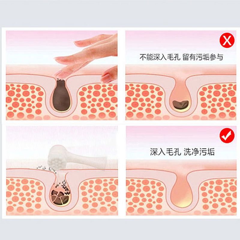 New Face Cleansing Brush Blackhead Removal Product Pore Cleaner Exfoliator Face Scrub Brush Double-Sided Facial Cleanser 1pcs ACU