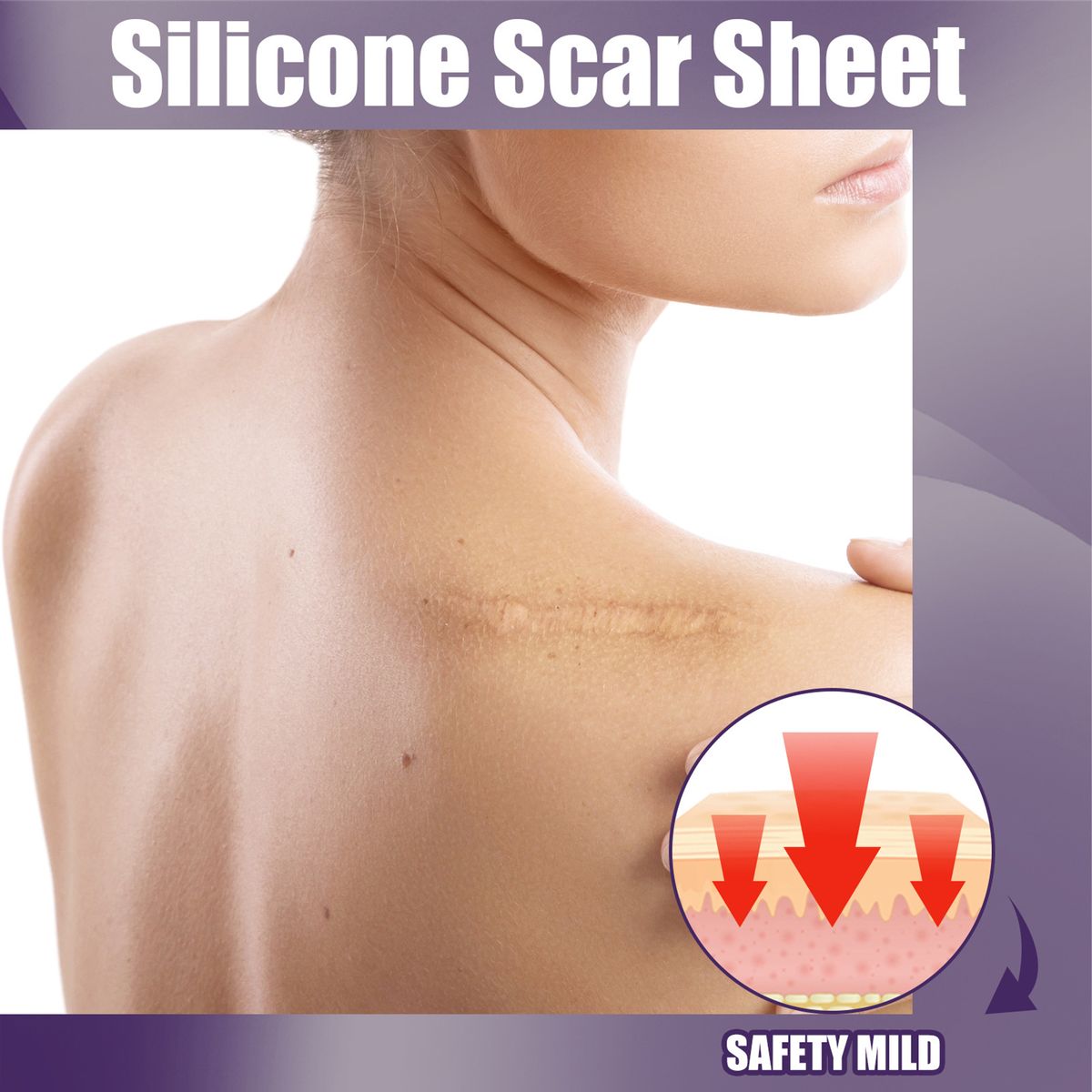 8Pcs Silicone Scar Sheets Safety Mild Odorless