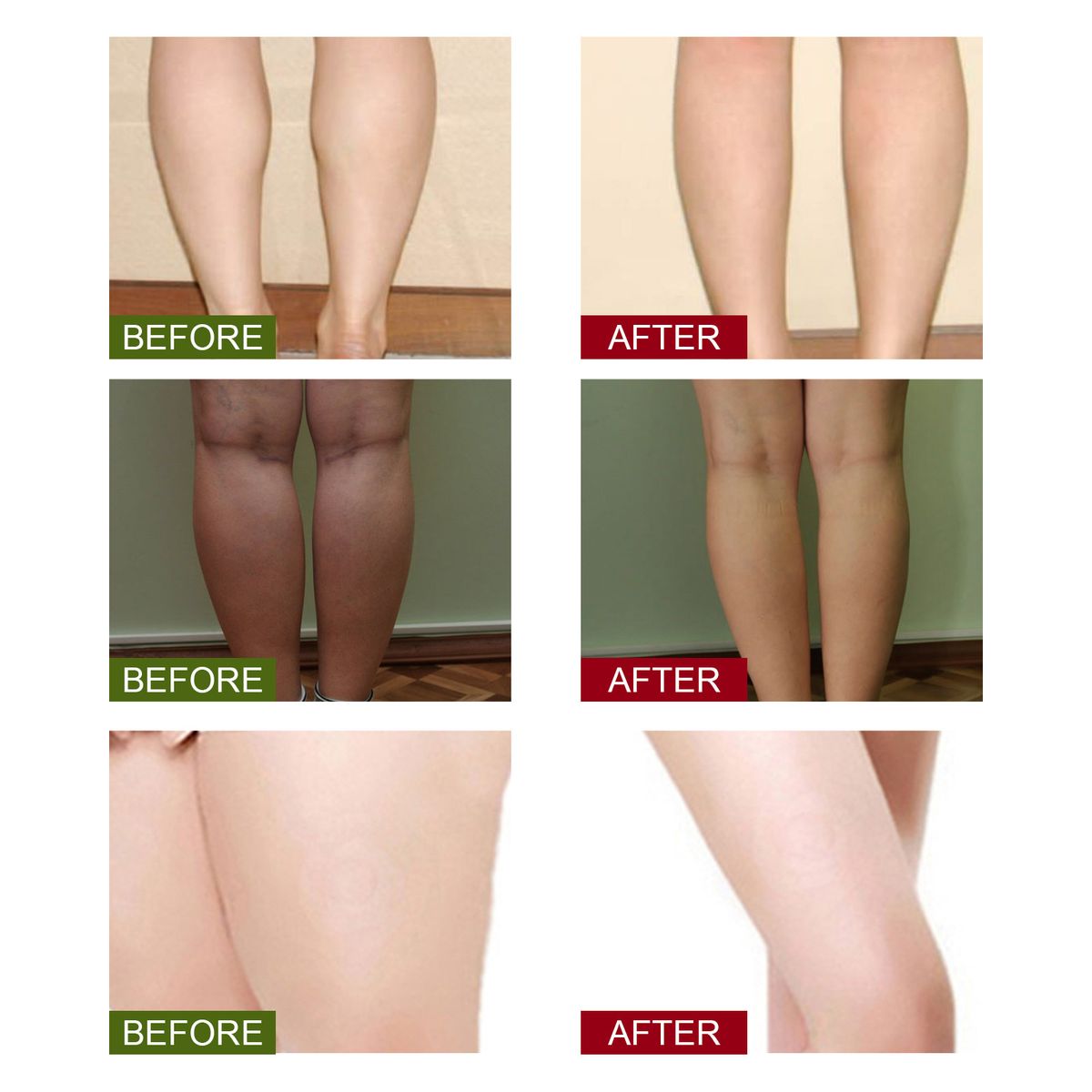 Leg Slimming Foot Bath Bags Wormwood Ginger Foot Soak Foot