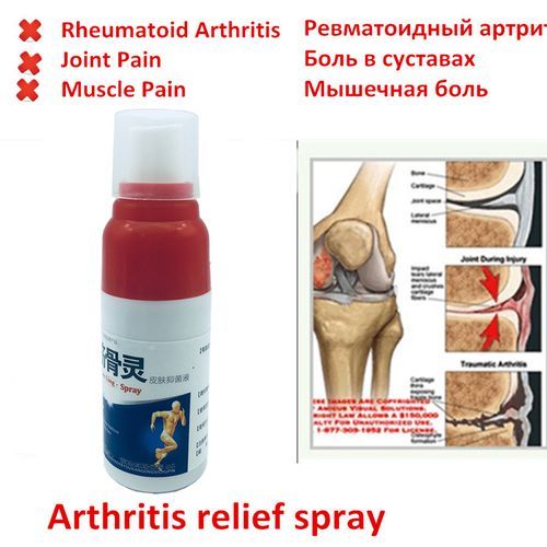 Multi Tiger Arthritis, Spray Waist Spray Back Pain Rheumatism Sprain Pain, Shoulder