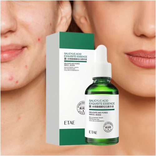 Salicylic Acid Acne Remedy  & Soothing Face Serum +Hyaluronic Acid X2