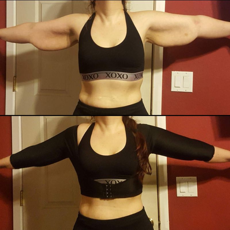 Women Back Arm Body Shoulder Corrector Slimming Arm Shapewear Short Sleeve Sexy Crop Tops Control Shapewear