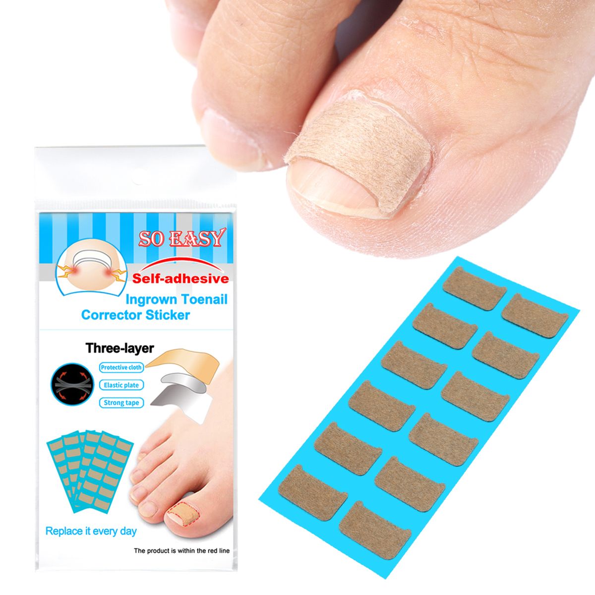 Ingrown Nail Correction Kit Ingrown Toenail Stickers