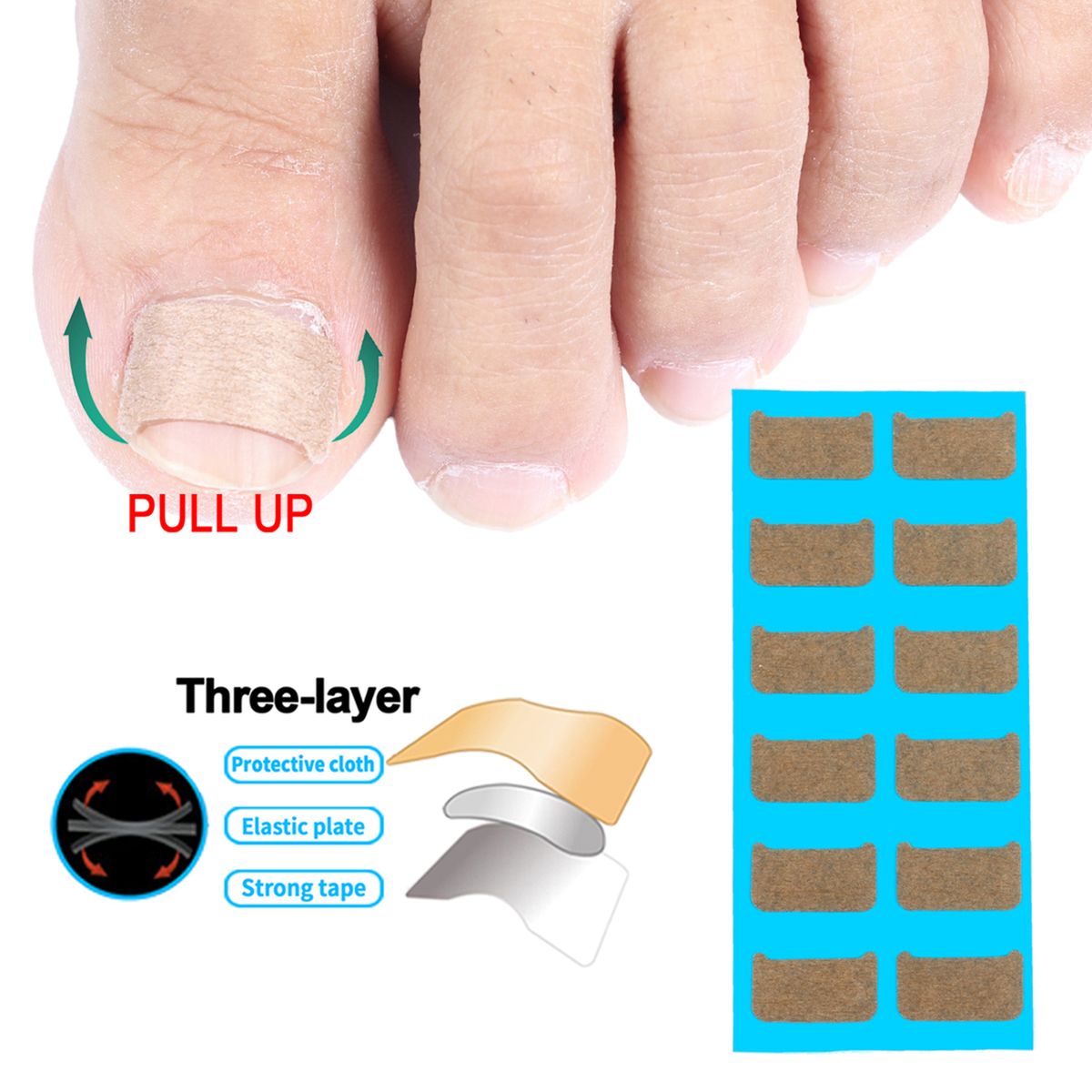 Ingrown Nail Correction Kit Ingrown Toenail Stickers