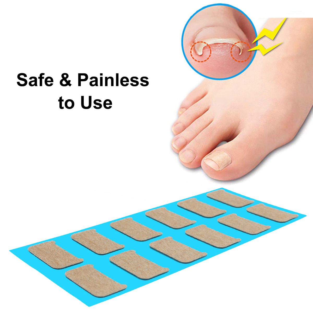 Ingrown Nail Correction Kit Ingrown Toenail Stickers