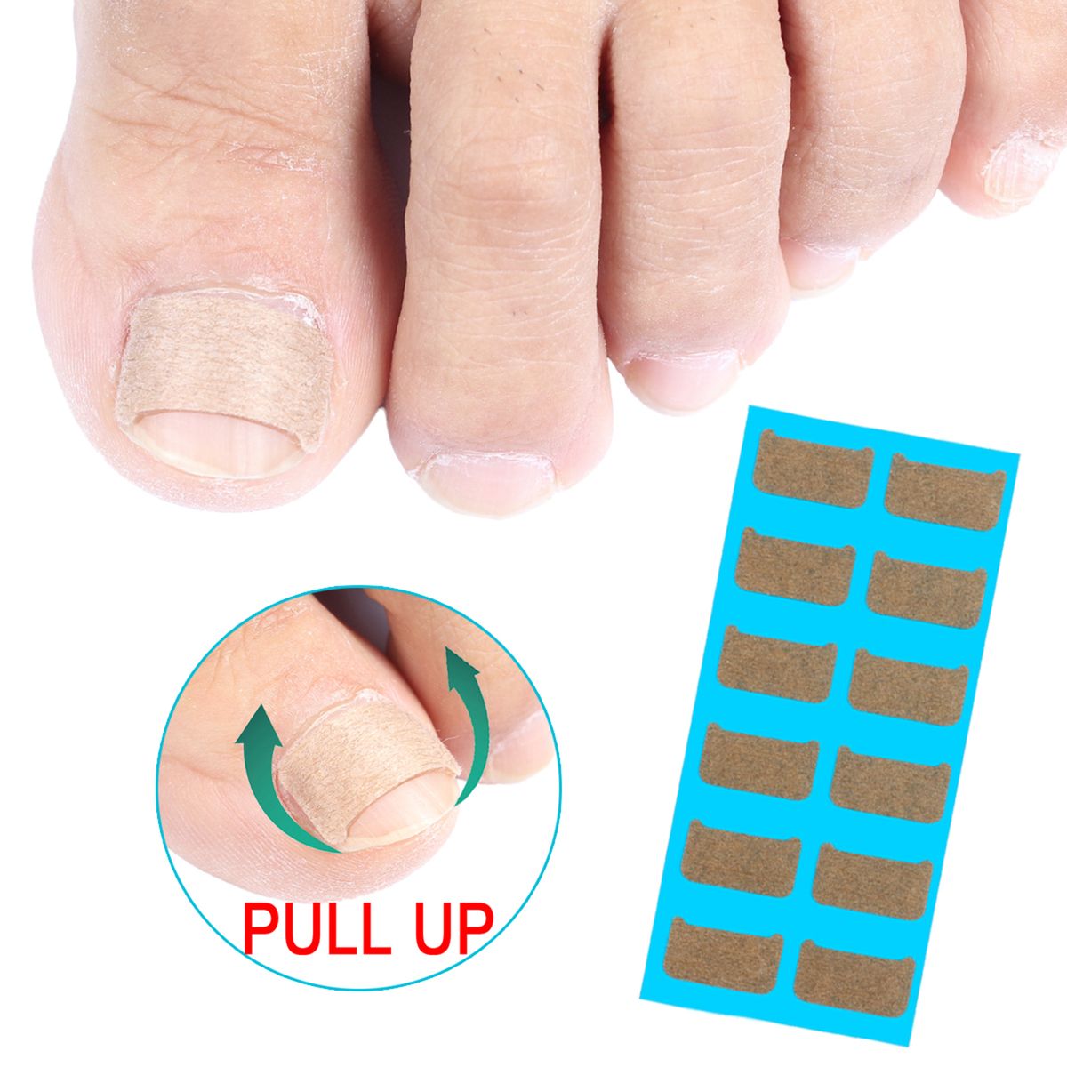 Ingrown Nail Correction Kit Ingrown Toenail Stickers