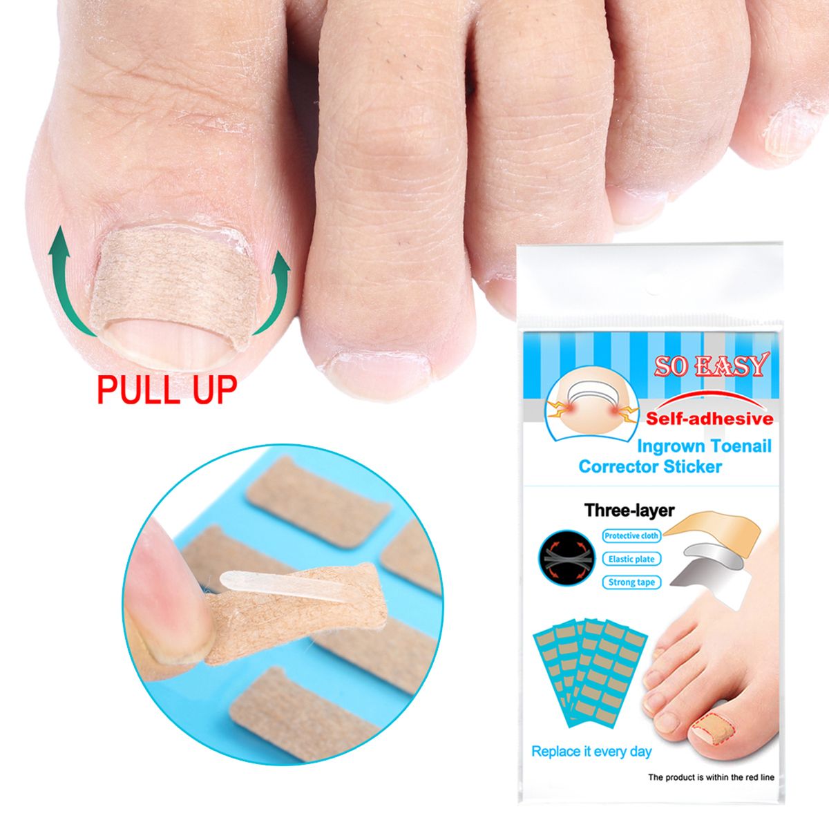 Ingrown Nail Correction Kit Ingrown Toenail Stickers