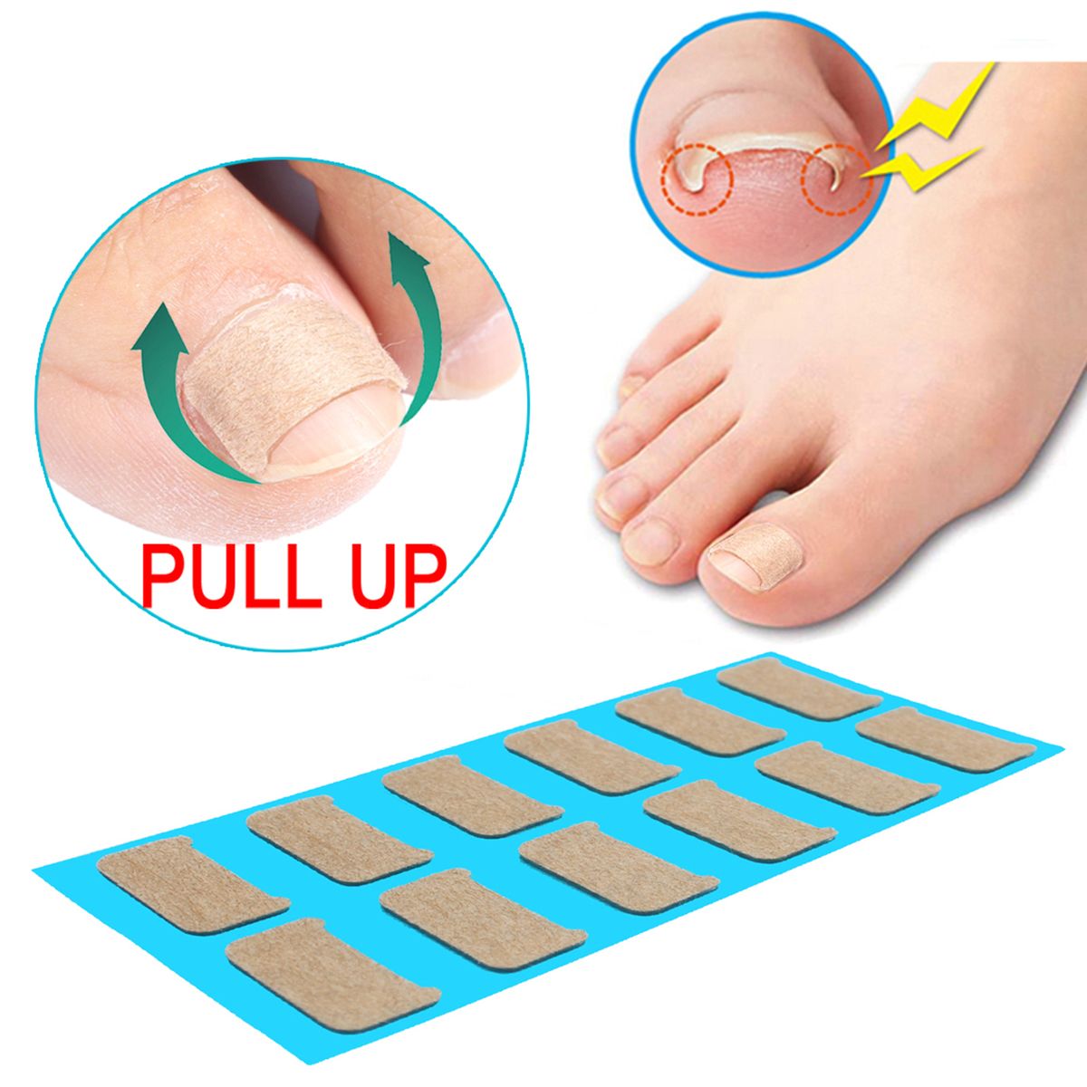 Ingrown Nail Correction Kit Ingrown Toenail Stickers