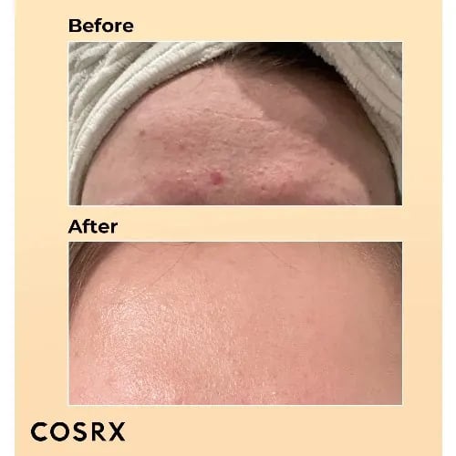 Cosrx Advanced Snail 96 Mucin Power Essence - 100ml