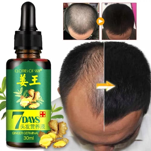 7days Ginger Hair Growth - 30ml