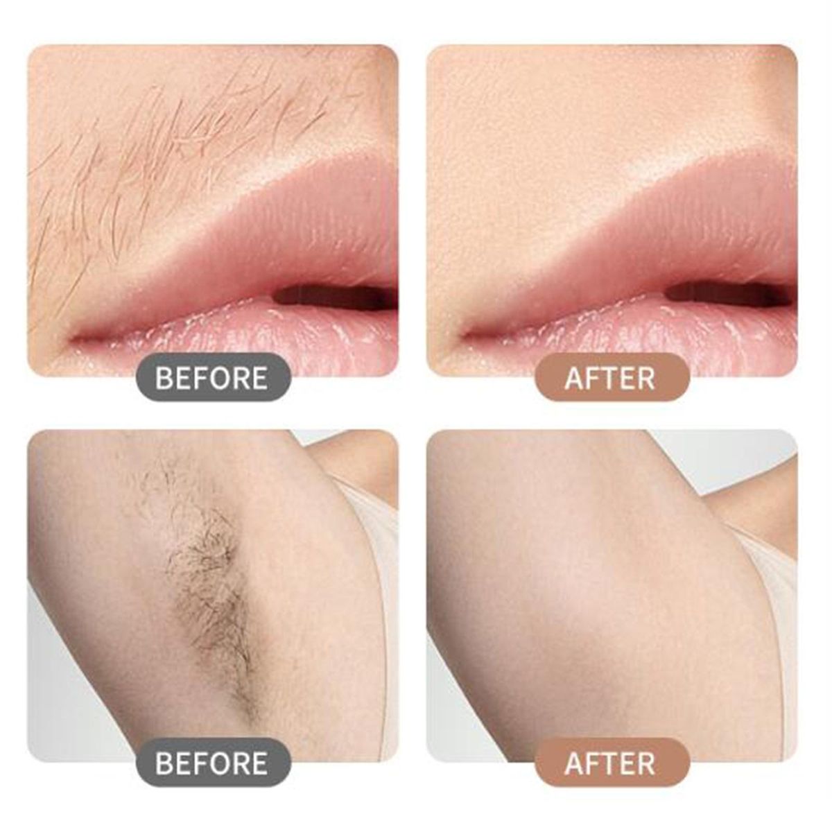 Portable Electric  Body Hair Removal Battery Powered