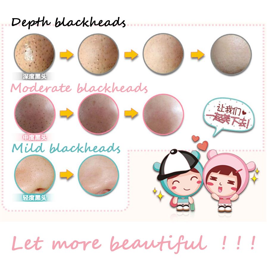 Cosmetic Head Massage Holika Kit Sticker Remover Holika Blackhead Nose Pig Remove Acne 7pcs Step Black D0164 3