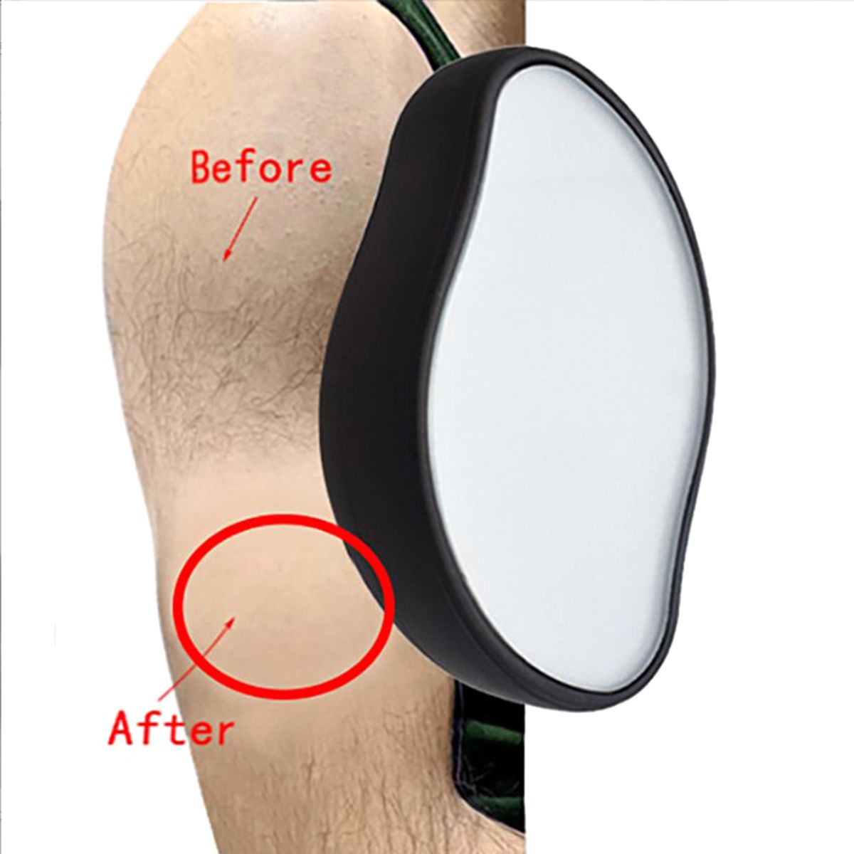 Painlessl Manua Hair Removal Eraser Skin Exfoliator Tool