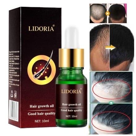 Natural Lidoria Hair Growth Oil-10ml