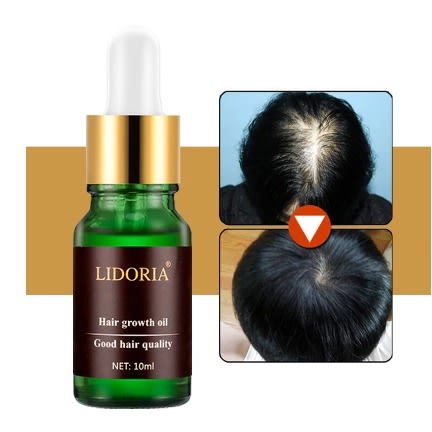 Natural Lidoria Hair Growth Oil-10ml