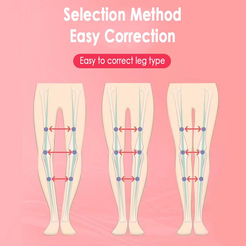 Posture Corrector Type Straightening X O For Leg Innovative