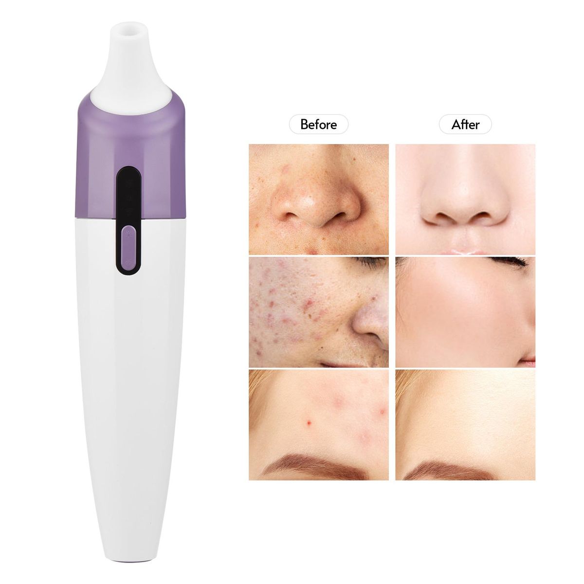 Blackhead Pore Vacuum Cleaner Remover with Camera Hot Compress Function 3 Different Powerful Suction  Probes 2 Adjustable Suction Level for Women & Men Comedone Whitehead all Skin with USB Cable Purple