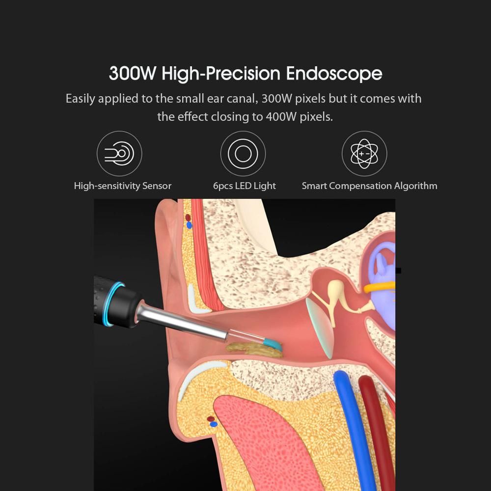 Bebird Smart Visual Ear Stick M9 Pro Multifunctional 17 Picking Heads 300W High Precision Endoscope 350mAh with Magnetic Charge Base Visual Ear-picking