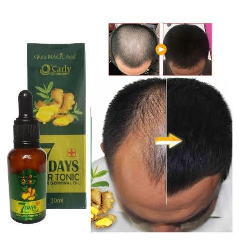 O'Carly - 7 Days Ginger Germinal Oil Hair Growth Tonic - 30ml