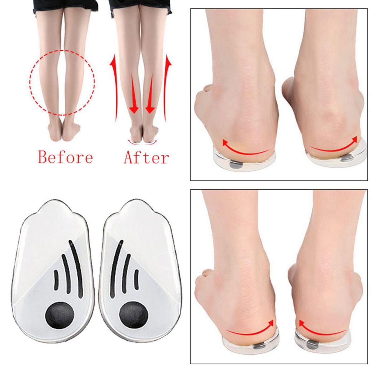 Height Increase Shoe Pad Foot Alignment Bow Legs M Size