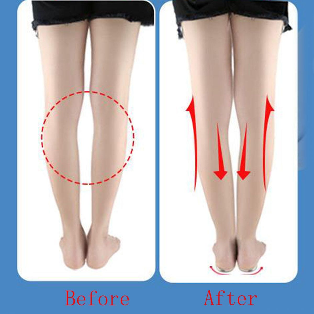 Height Increase Shoe Pad Foot Alignment Bow Legs M Size