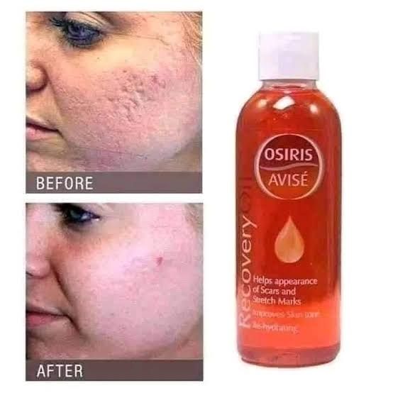 Recovery Oil
