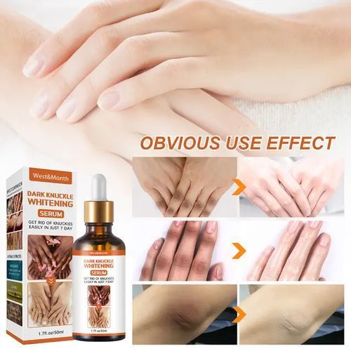 Fast Effective Dark Knuckle And Spot Removal Whitening Serum 2pcs