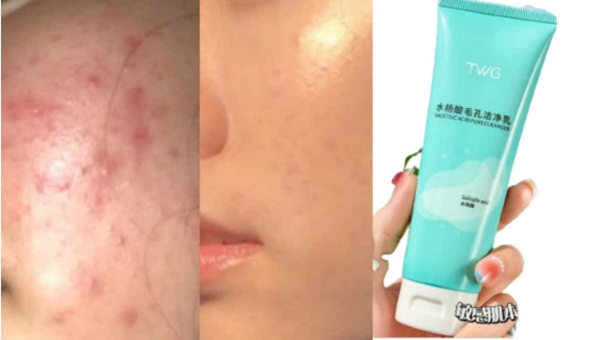 Salicylic Acid Pore  Cleanser