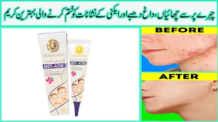 3 Days Clear Strong Acne Ointment