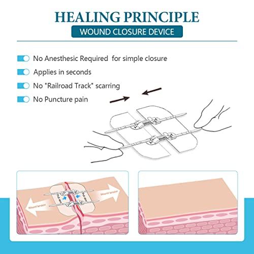 Zip Stitch Sutures Butterfly Bandaids  2 Pcs Zipstitch Lacer