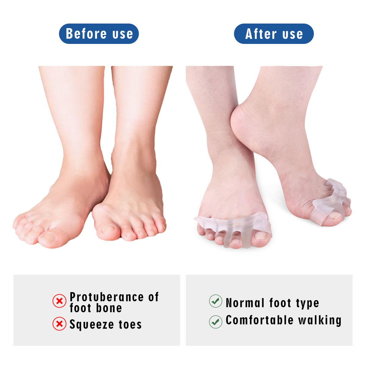 Silicone Bunion Corrector Toe Separator Relieve Swelling