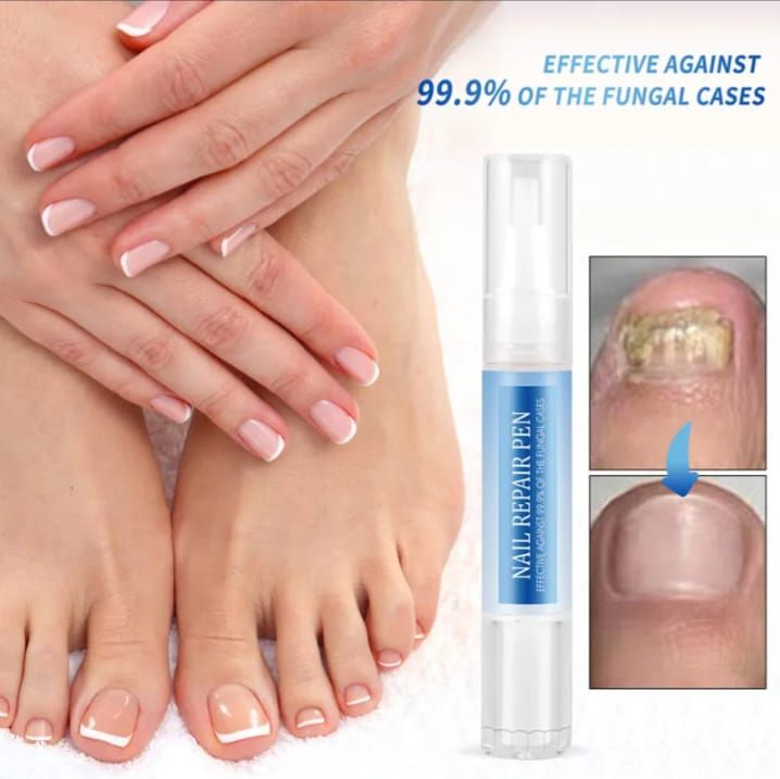 Effective 99.9% Anti Fungal Nail Repair Treatment Pen