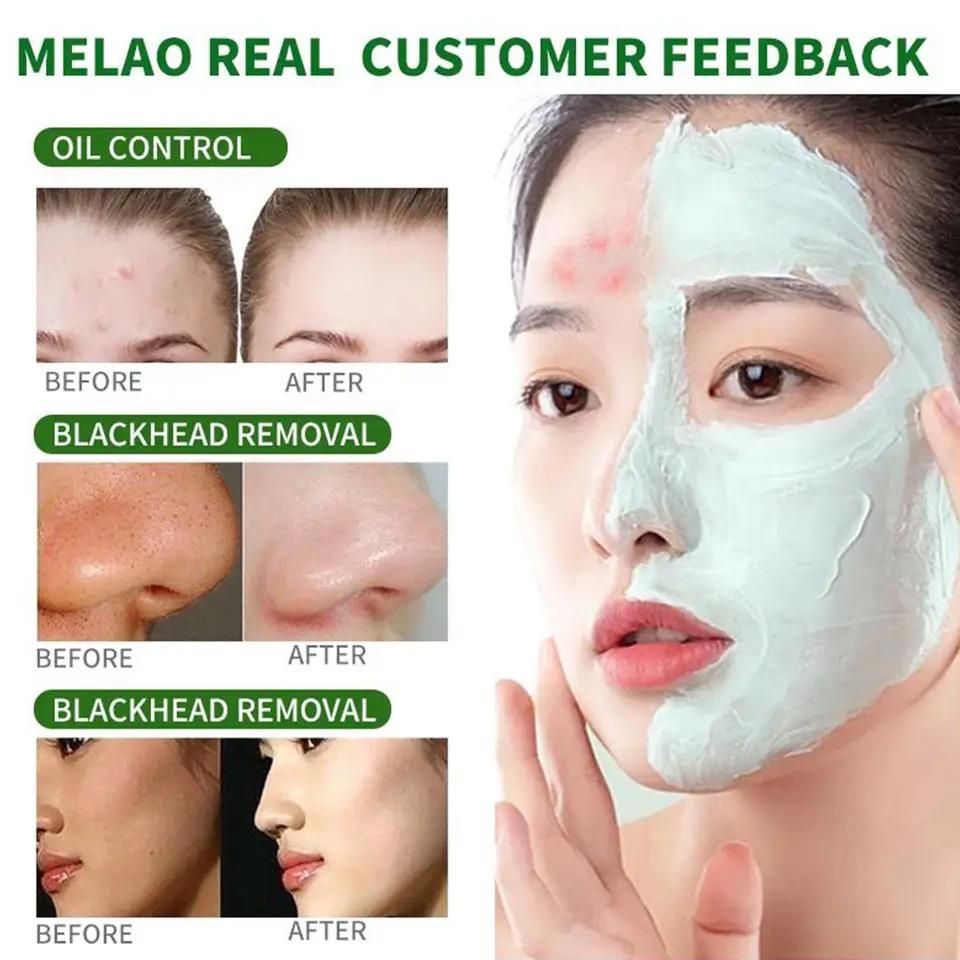 Green Mask Stick Facial Mask For Black Spots & Pimples