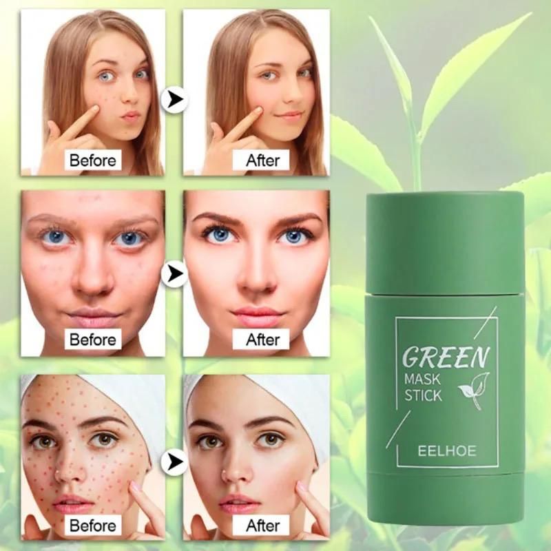 Green Mask Stick Facial Mask For Black Spots & Pimples