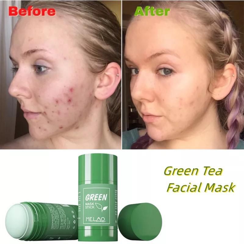 Green Mask Stick Facial Mask For Black Spots & Pimples