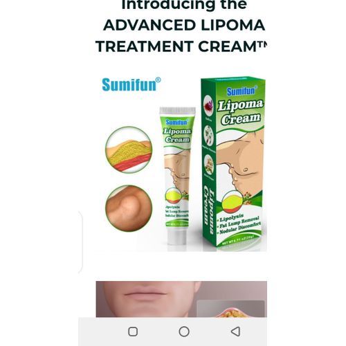 Effective Lipoma Removal Cream/ Fat Lump Removal