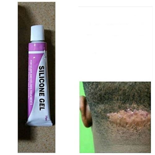 Scar/Tribal Mark/Keloid Silicone Gel Flattener