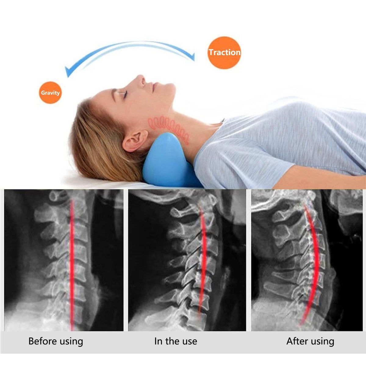 Neck Repair Pillow Spine Alignment Neck Pillow Blue