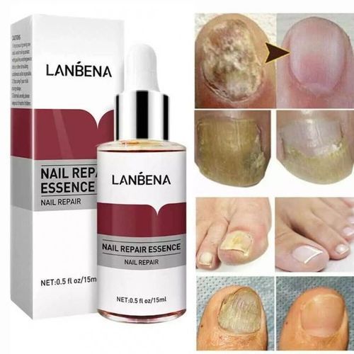 2 Nail Repair Essence And Anti-fungal Solution (15ml)