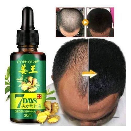 7Days Ginger Germinal Oil For Hair Loss And Bald Head Serum